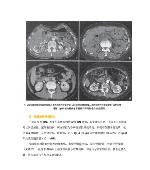 LGG4c手机综合评测（功能强大，性能优越，细节出色）